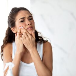 łojotokowe zapalenie skóry twarzy